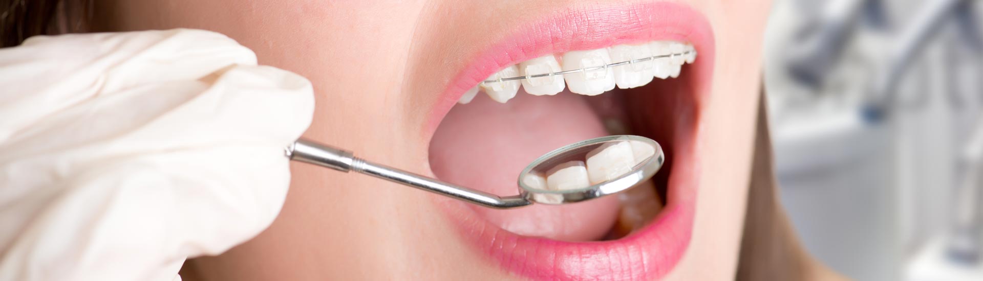 Orthodontics | Our expertise